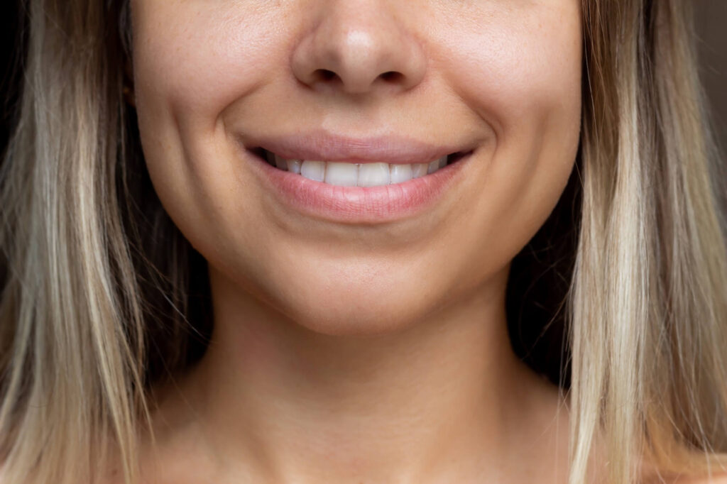 Dimple